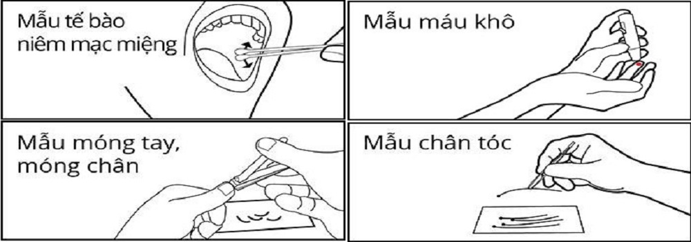 Bảng giá Xét nghiệm ADN làm Giấy khai sinh, Bảng giá Xét nghiệm ADN làm Giấy khai sinh, nhập tịch